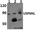 Western blot (WB) analysis of USP6NL polyclonal antibody at 1:500 dilution
Lane1:Jurkat whole cell lysate(40ug)
Lane2:PC12 whole cell lysate(40ug)
Lane3:RAW264.7 whole cell lysate(40ug)