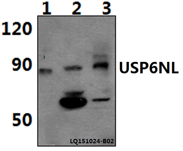 Western blot (WB) analysis of USP6NL polyclonal antibody at 1:500 dilution
Lane1:Jurkat whole cell lysate(40ug)
Lane2:PC12 whole cell lysate(40ug)
Lane3:RAW264.7 whole cell lysate(40ug)