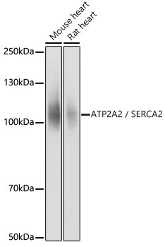 Western blot analysis of extracts of various cell lines, using ATP2A2 / SERCA2 antibody  at 1:10000 dilution.
Secondary antibody: HRP Goat Anti-Rabbit IgG   at 1:10000 dilution.
Lysates/proteins: 25ug per lane.
Blocking buffer: 3% nonfat dry milk in TBST.
Detection: ECL Basic Kit .
Exposure time: 1s.
