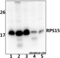Western blot (WB) analysis of RPS15 polyclonal antibody at 1:500 dilution
Lane1:SK-OVCAR3 whole cell lysate(40ug)
Lane2:HEK293T whole cell lysate(40ug)
Lane3:A549 whole cell lysate(40ug)
Lane4:AML-12 whole cell lysate(40ug)
Lane5:PC12 whole cell lysate(40ug)