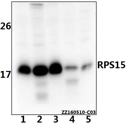 Western blot (WB) analysis of RPS15 polyclonal antibody at 1:500 dilution
Lane1:SK-OVCAR3 whole cell lysate(40ug)
Lane2:HEK293T whole cell lysate(40ug)
Lane3:A549 whole cell lysate(40ug)
Lane4:AML-12 whole cell lysate(40ug)
Lane5:PC12 whole cell lysate(40ug)