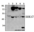 Western blot (WB) analysis of SOX17 polyclonal antibody at 1:500 dilution
Lane1:MCF-7 whole cell lysate(40ug)
Lane2:HCT116 whole cell lysate(40ug)
Lane3:SK-OVCAR3 whole cell lysate(40ug)
Lane4:The Spleen lysate of Mouse(40ug)
Lane5:The Spleen lysate of Rat(40ug)