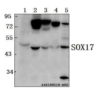 Western blot (WB) analysis of SOX17 polyclonal antibody at 1:500 dilution
Lane1:MCF-7 whole cell lysate(40ug)
Lane2:HCT116 whole cell lysate(40ug)
Lane3:SK-OVCAR3 whole cell lysate(40ug)
Lane4:The Spleen lysate of Mouse(40ug)
Lane5:The Spleen lysate of Rat(40ug)