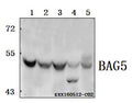 Western blot (WB) analysis of BAG5 polyclonal antibody at 1:500 dilution
Lane1:SK-OVCAR3 whole cell lysate(40ug)
Lane2:HCT116 whole cell lysate(40ug)
Lane3:L02 whole cell lysate(40ug)
Lane4:The Testis lysate of Mouse(40ug)
Lane5:The Testis lysate of Rat(40ug)