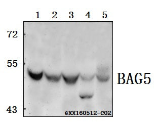 Western blot (WB) analysis of BAG5 polyclonal antibody at 1:500 dilution
Lane1:SK-OVCAR3 whole cell lysate(40ug)
Lane2:HCT116 whole cell lysate(40ug)
Lane3:L02 whole cell lysate(40ug)
Lane4:The Testis lysate of Mouse(40ug)
Lane5:The Testis lysate of Rat(40ug)