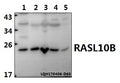Western blot (WB) analysis of RASL10B polyclonal antibody at 1:500 dilution
Lane1:A549 whole cell lysate(40ug)
Lane2:LOVO whole cell lysate(40ug)
Lane3:SP2/0 whole cell lysate(40ug)
Lane4:PMVEC whole cell lysate(40ug)
Lane5:Hela whole cell lysate(40ug)