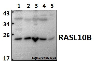 Western blot (WB) analysis of RASL10B polyclonal antibody at 1:500 dilution
Lane1:A549 whole cell lysate(40ug)
Lane2:LOVO whole cell lysate(40ug)
Lane3:SP2/0 whole cell lysate(40ug)
Lane4:PMVEC whole cell lysate(40ug)
Lane5:Hela whole cell lysate(40ug)