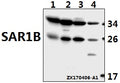 Western blot (WB) analysis of SAR1B polyclonal antibody at 1:500 dilution
Lane1:The Brain tissue lysate of Mouse(40ug)
Lane2:The Brain tissue lysate of Rat(40ug)
Lane3:HepG2 whole cell lysate(40ug)
Lane4:HCT116 whole cell lysate(40ug)