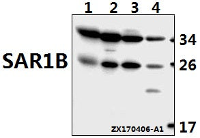 Western blot (WB) analysis of SAR1B polyclonal antibody at 1:500 dilution
Lane1:The Brain tissue lysate of Mouse(40ug)
Lane2:The Brain tissue lysate of Rat(40ug)
Lane3:HepG2 whole cell lysate(40ug)
Lane4:HCT116 whole cell lysate(40ug)
