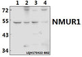 Western blot (WB) analysis of NMUR1 polyclonal antibody at 1:500 dilution
Lane1:The Testis tissue lysate of Rat(40ug)
Lane2:The Testis tissue lysate of Mouse(40ug)
Lane3:SGC-7901 whole cell lysate(40ug)
Lane4:K562 whole cell lysate(40ug)