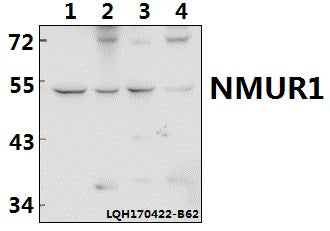 Western blot (WB) analysis of NMUR1 polyclonal antibody at 1:500 dilution
Lane1:The Testis tissue lysate of Rat(40ug)
Lane2:The Testis tissue lysate of Mouse(40ug)
Lane3:SGC-7901 whole cell lysate(40ug)
Lane4:K562 whole cell lysate(40ug)
