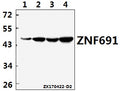 Western blot (WB) analysis of ZNF691 polyclonal antibody at 1:500 dilution
Lane1:MCF-7 whole cell lysate(40ug)
Lane2:HepG2 whole cell lysate(40ug)
Lane3:PC12 whole cell lysate(40ug)
Lane4:MEF whole cell lysate(40ug)