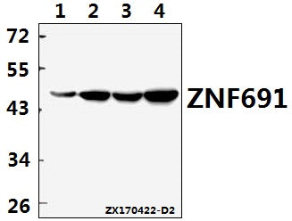 Western blot (WB) analysis of ZNF691 polyclonal antibody at 1:500 dilution
Lane1:MCF-7 whole cell lysate(40ug)
Lane2:HepG2 whole cell lysate(40ug)
Lane3:PC12 whole cell lysate(40ug)
Lane4:MEF whole cell lysate(40ug)