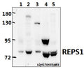 Western blot (WB) analysis of REPS1 polyclonal antibody at 1:500 dilution
Lane1:A549 whole cell lysate(40ug)
Lane2:L02 whole cell lysate(40ug)
Lane3:Hela whole cell lysate(40ug)
Lane4:The Testis tissue lysate of Rat(40ug)
Lane5:The Testis tissue lysate of Mouse(40ug)