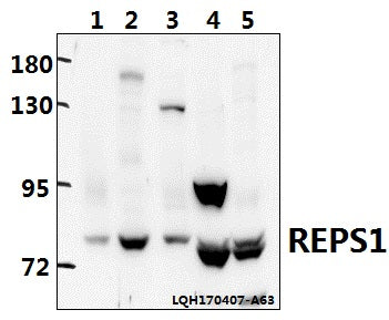 Western blot (WB) analysis of REPS1 polyclonal antibody at 1:500 dilution
Lane1:A549 whole cell lysate(40ug)
Lane2:L02 whole cell lysate(40ug)
Lane3:Hela whole cell lysate(40ug)
Lane4:The Testis tissue lysate of Rat(40ug)
Lane5:The Testis tissue lysate of Mouse(40ug)