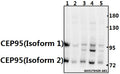 Western blot (WB) analysis of CEP95 polyclonal antibody at 1:500 dilution
Lane1:CT26 whole cell lysate(40ug)
Lane2:PC12 whole cell lysate(40ug)
Lane3:A549 whole cell lysate(40ug)
Lane4:HEK293T whole cell lysate(40ug)
Lane5:L02 whole cell lysate(40ug)