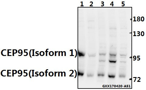 Western blot (WB) analysis of CEP95 polyclonal antibody at 1:500 dilution
Lane1:CT26 whole cell lysate(40ug)
Lane2:PC12 whole cell lysate(40ug)
Lane3:A549 whole cell lysate(40ug)
Lane4:HEK293T whole cell lysate(40ug)
Lane5:L02 whole cell lysate(40ug)