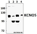 KCNQ5 polyclonal antibody – Figure 1 of 1
