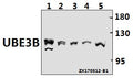 Western blot (WB) analysis of UBE3B polyclonal antibody at 1:500 dilution
Lane1:PC12 whole cell lysate(40ug)
Lane2:CT26 whole cell lysate(40ug)
Lane3:SGC7901 whole cell lysate(40ug)
Lane4:MCF-7 whole cell lysate(40ug)
Lane5:HEK293T whole cell lysate(40ug)