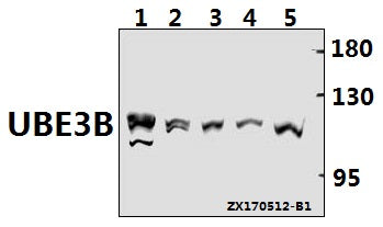 Western blot (WB) analysis of UBE3B polyclonal antibody at 1:500 dilution
Lane1:PC12 whole cell lysate(40ug)
Lane2:CT26 whole cell lysate(40ug)
Lane3:SGC7901 whole cell lysate(40ug)
Lane4:MCF-7 whole cell lysate(40ug)
Lane5:HEK293T whole cell lysate(40ug)