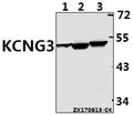 Western blot (WB) analysis of KCNG3 polyclonal antibody at 1:500 dilution
Lane1:C6 whole cell lysate(40ug)
Lane2:AML-12 whole cell lysate(40ug)
Lane3:HCT116 whole cell lysate(40ug)