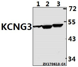 Western blot (WB) analysis of KCNG3 polyclonal antibody at 1:500 dilution
Lane1:C6 whole cell lysate(40ug)
Lane2:AML-12 whole cell lysate(40ug)
Lane3:HCT116 whole cell lysate(40ug)