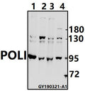 Western blot (WB) analysis of POLI polyclonal antibody at 1:500 dilution
Lane1:HEK293T whole cell lysate(40ug)
Lane2:A375 whole cell lysate(40ug)
Lane3:HCT116 whole cell lysate(40ug)
Lane4:SGC7901 whole cell lysate(40ug)