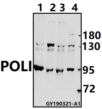 Western blot (WB) analysis of POLI polyclonal antibody at 1:500 dilution
Lane1:HEK293T whole cell lysate(40ug)
Lane2:A375 whole cell lysate(40ug)
Lane3:HCT116 whole cell lysate(40ug)
Lane4:SGC7901 whole cell lysate(40ug)