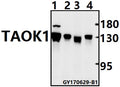 Western blot (WB) analysis of TAOK1 polyclonal antibody at 1:500 dilution
Lane1:SK-OVCAR3 whole cell lysate(40ug)
Lane2:A2780 whole cell lysate(40ug)
Lane3:The Testis tissue lysate of Rat(40ug)
Lane4:The Testis tissue lysate of Mouse(40ug)