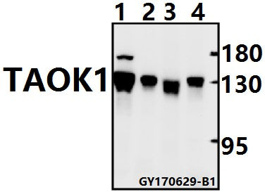 Western blot (WB) analysis of TAOK1 polyclonal antibody at 1:500 dilution
Lane1:SK-OVCAR3 whole cell lysate(40ug)
Lane2:A2780 whole cell lysate(40ug)
Lane3:The Testis tissue lysate of Rat(40ug)
Lane4:The Testis tissue lysate of Mouse(40ug)