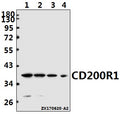 Western blot (WB) analysis of CD200R1 polyclonal antibody at 1:1000 dilution
Lane1:L02 whole cell lysate(40ug)
Lane2:A549 whole cell lysate(40ug)
Lane3:AML-12 whole cell lysate(40ug)
Lane4:H9C2 whole cell lysate(40ug)