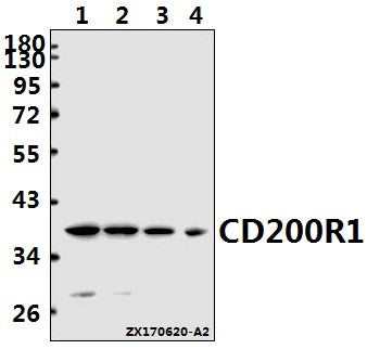 Western blot (WB) analysis of CD200R1 polyclonal antibody at 1:1000 dilution
Lane1:L02 whole cell lysate(40ug)
Lane2:A549 whole cell lysate(40ug)
Lane3:AML-12 whole cell lysate(40ug)
Lane4:H9C2 whole cell lysate(40ug)
