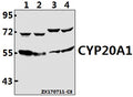Western blot (WB) analysis of CYP20A1 polyclonal antibody at 1:500 dilution
Lane1:MCF-7 whole cell lysate(40ug)
Lane2:HepG2 whole cell lysate(40ug)
Lane3:AML-12 whole cell lysate(40ug)
Lane4:PC12 whole cell lysate(40ug)