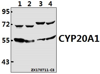 Western blot (WB) analysis of CYP20A1 polyclonal antibody at 1:500 dilution
Lane1:MCF-7 whole cell lysate(40ug)
Lane2:HepG2 whole cell lysate(40ug)
Lane3:AML-12 whole cell lysate(40ug)
Lane4:PC12 whole cell lysate(40ug)