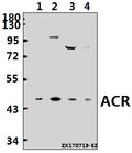 Western blot (WB) analysis of ACR polyclonal antibody at 1:500 dilution
Lane1:HepG2 whole cell lysate(40ug)
Lane2:HEK293T whole cell lysate(40ug)
Lane3:MCF-7 whole cell lysate(40ug)
Lane4:L02 whole cell lysate(40ug)