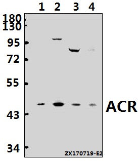 Western blot (WB) analysis of ACR polyclonal antibody at 1:500 dilution
Lane1:HepG2 whole cell lysate(40ug)
Lane2:HEK293T whole cell lysate(40ug)
Lane3:MCF-7 whole cell lysate(40ug)
Lane4:L02 whole cell lysate(40ug)