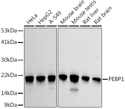 Western blot analysis of extracts of various cell lines, using PEBP1  antibody  at 1:1000 dilution.
Secondary antibody: HRP Goat Anti-Rabbit IgG   at 1:10000 dilution.
Lysates/proteins: 25ug per lane.
Blocking buffer: 3% nonfat dry milk in TBST.
Detection: ECL Basic Kit .
Exposure time: 30s.