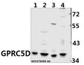 Western blot (WB) analysis of GPRC5D pAb at 1:500 dilution
Lane1:SGC7901 whole cell lysate(40ug)
Lane2:PANC1 whole cell lysate(40ug)
Lane3:CT26 whole cell lysate(40ug)
Lane4:PC12 whole cell lysate(40ug)