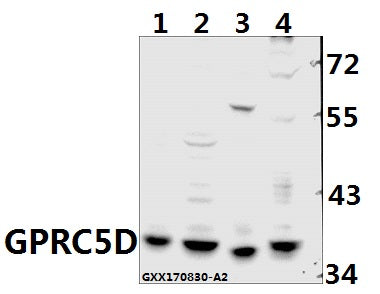 Western blot (WB) analysis of GPRC5D pAb at 1:500 dilution
Lane1:SGC7901 whole cell lysate(40ug)
Lane2:PANC1 whole cell lysate(40ug)
Lane3:CT26 whole cell lysate(40ug)
Lane4:PC12 whole cell lysate(40ug)