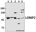 Western blot (WB) analysis of LONP2 pAb at 1:500 dilution
Lane1:A549 whole cell lysate(40ug)
Lane2:A2780 whole cell lysate(40ug)
Lane3:HEK293T whole cell lysate(40ug)
Lane4:AML-12 whole cell lysate(40ug)
Lane5:H9C2 whole cell lysate(40ug)