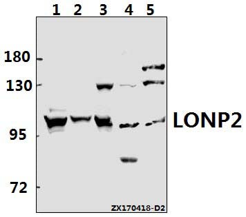 Western blot (WB) analysis of LONP2 pAb at 1:500 dilution
Lane1:A549 whole cell lysate(40ug)
Lane2:A2780 whole cell lysate(40ug)
Lane3:HEK293T whole cell lysate(40ug)
Lane4:AML-12 whole cell lysate(40ug)
Lane5:H9C2 whole cell lysate(40ug)