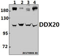 Western blot (WB) analysis of DDX20 pAb at 1:500 dilution
Lane1:A549 whole cell lysate(40ug)
Lane2:HCC827 whole cell lysate(40ug)
Lane3:H9C2 whole cell lysate(40ug)
Lane4:CT26 whole cell lysate(40ug)