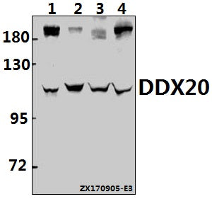 Western blot (WB) analysis of DDX20 pAb at 1:500 dilution
Lane1:A549 whole cell lysate(40ug)
Lane2:HCC827 whole cell lysate(40ug)
Lane3:H9C2 whole cell lysate(40ug)
Lane4:CT26 whole cell lysate(40ug)