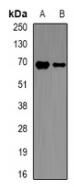 Western blot analysis of p67 phox expression in THP1 (A), mouse spleen (B) whole cell lysates.