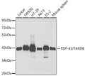 Western blot analysis of extracts of various cell lines, using TDP-43/TARDB antibody  at 1:1000 dilution.
Secondary antibody: HRP Goat Anti-Rabbit IgG   at 1:10000 dilution.
Lysates/proteins: 25ug per lane.
Blocking buffer: 3% nonfat dry milk in TBST.