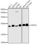 Western blot analysis of extracts of various cell lines, using CDC42 antibody  at 1:1000 dilution.
Secondary antibody: HRP Goat Anti-Rabbit IgG   at 1:10000 dilution.
Lysates/proteins: 25ug per lane.
Blocking buffer: 3% nonfat dry milk in TBST.
Detection: ECL Basic Kit .
Exposure time: 180s.