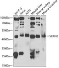 Western blot analysis of extracts of various cell lines, using SCRN2 antibody  at 1:1000 dilution.
Secondary antibody: HRP Goat Anti-Rabbit IgG   at 1:10000 dilution.
Lysates/proteins: 25ug per lane.
Blocking buffer: 3% nonfat dry milk in TBST.