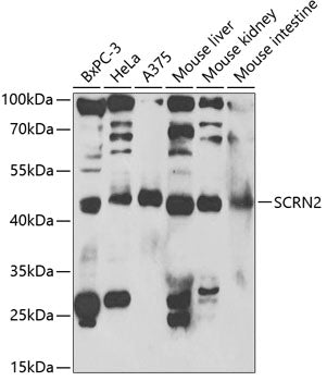Western blot analysis of extracts of various cell lines, using SCRN2 antibody  at 1:1000 dilution.
Secondary antibody: HRP Goat Anti-Rabbit IgG   at 1:10000 dilution.
Lysates/proteins: 25ug per lane.
Blocking buffer: 3% nonfat dry milk in TBST.
