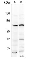 Western blot analysis of various lysates, using NRF2 antibody  at ARC50393-02 dilution.HeLa cells were treated by MG132 at 37℃ for 90 minutes.
Secondary antibody: HRP Goat Anti-Rabbit IgG   at 1:10000 dilution.
Lysates/proteins: 25ug per lane.
Blocking buffer: 3% nonfat dry milk in TBST.
Detection: ECL Basic Kit .
Exposure time: 30s.