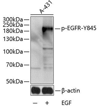 Phospho-EGFR-Y845 polyclonal antibody – Figure 1 of 1